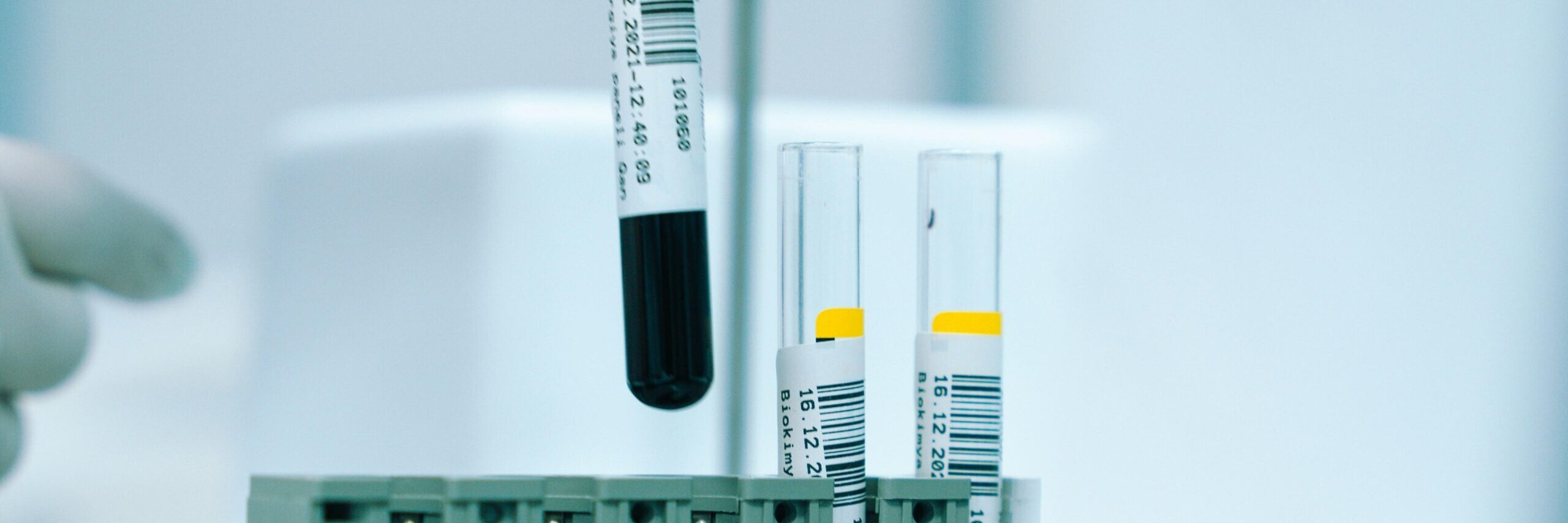 Could universal opt-out HIV testing in Italian emergency departments be a cost-effective way of increasing HIV diagnosis rates in Italy?  