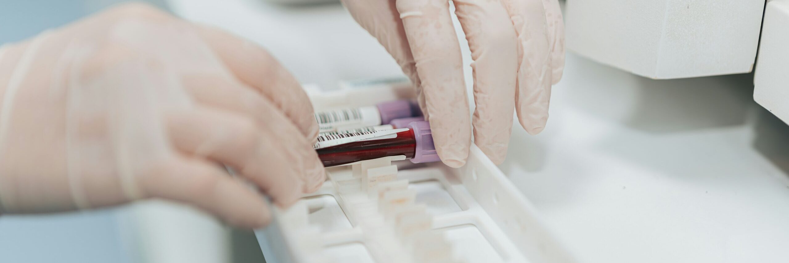 Estimating the potential health economic value of introducing universal opt-out testing for HIV in emergency departments in Italy 