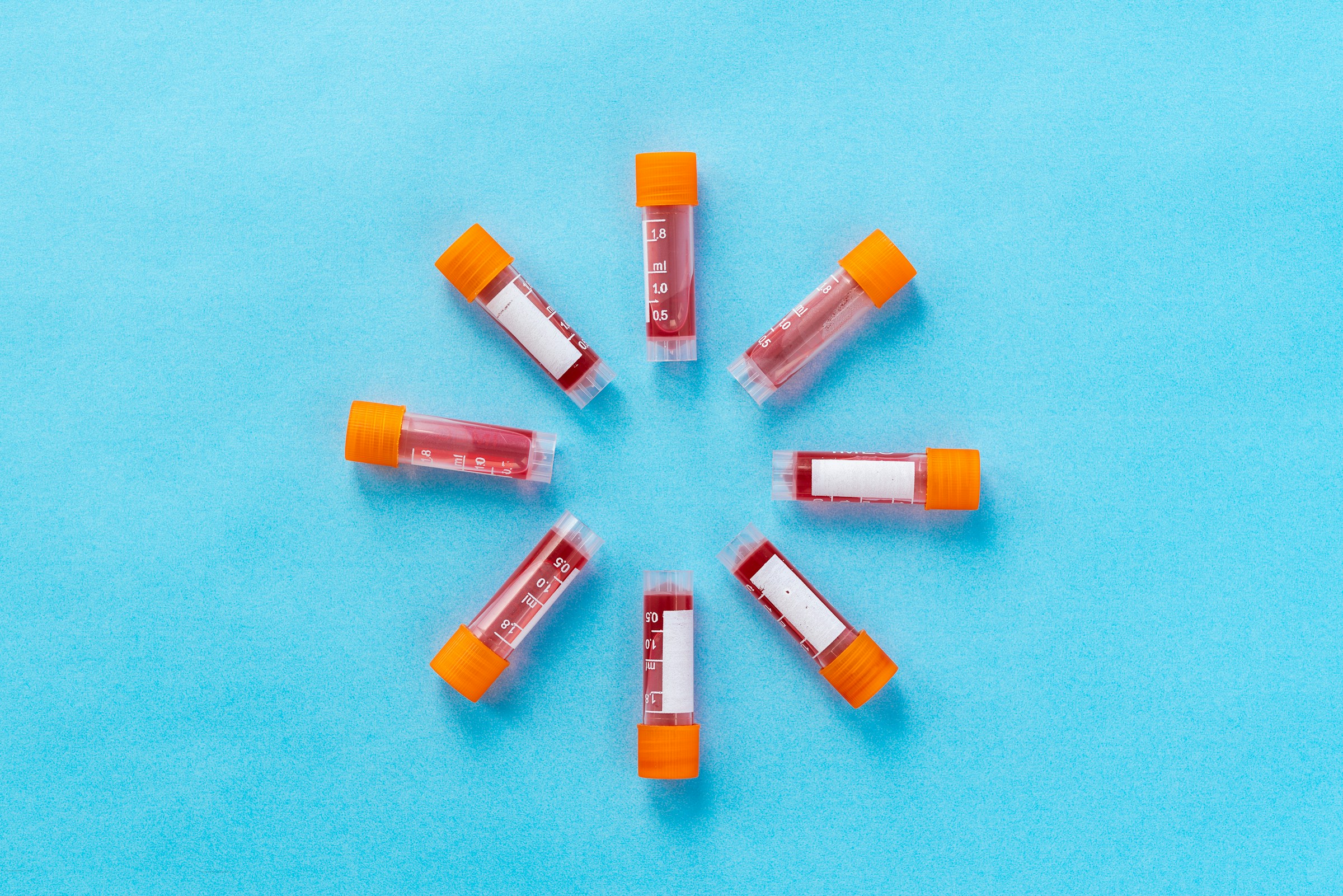 New analysis suggests emergency department blood-borne virus testing could be cost-effective in Poland